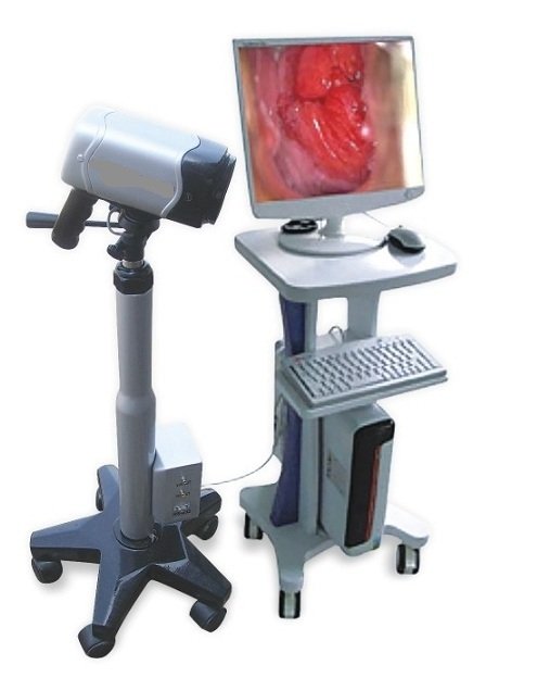 Digital Video Colposcope Specifications