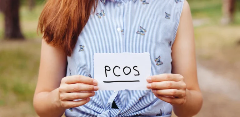 Best PCOS Treatment in Ramesh Nagar: A Comprehensive Guide